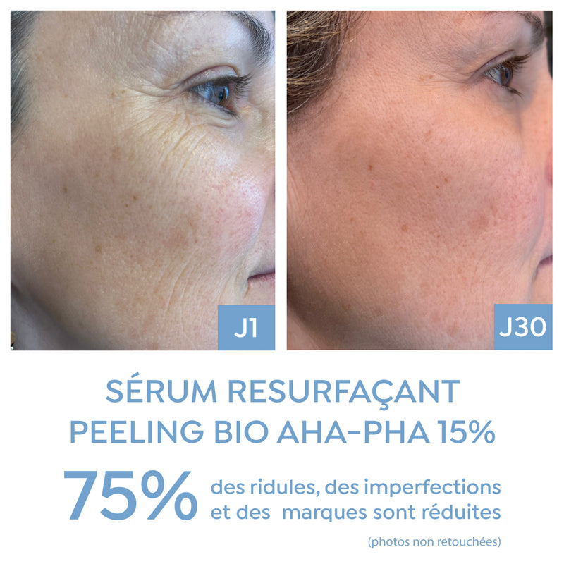 Sérum Resurfaçant Peeling AHA-PHA 15%